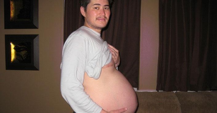 Terhes férfi, műtét után