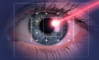 Biztonságosan és hatékonyan korrigál­ható a látás a LASIK műtéttel?