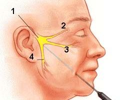 A trigeminus neuralgia (arcidegzsába) bármely életkorban felléphet.