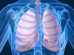A légmell, orvosi nevén pneumothorax, súlyos mellkasi sérülés eredménye is lehet