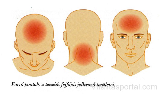 fejfájás a fej hátsó részén magas vérnyomás esetén