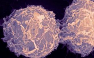 A daganatok korai felismerése javítja a gyógyulási esélyeket